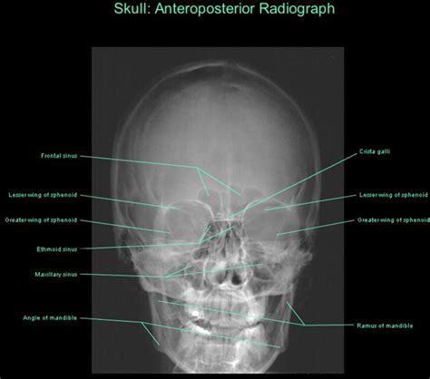 skull ap anatomy